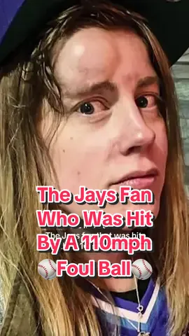 She was hit by a 110mph foul ball at a Jays game and now Liz McGuire is turning her inury into a way to help out a local charity @Daryn Jones @Deepa Prashad  #jays #bluejays 