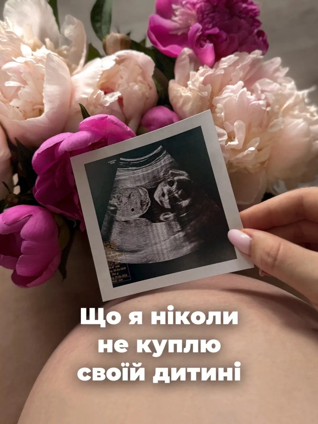 #вагітність #вагітність🤰🏻 #вагітна #вочікуванні #беременность 