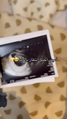 #بيبي👼🏻💙  #CapCut #fyp #AteQuando #foryoupageofficiall #foryou #تصوير_ايفون #ديارة_بيبي #تصويري #
