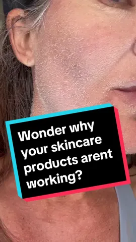 Thank you @SKNBODY forever grateful 🙏 #dermaplaning #skincare ##SkinCare101 #skincarehacks #skincareproducts #skincaretips