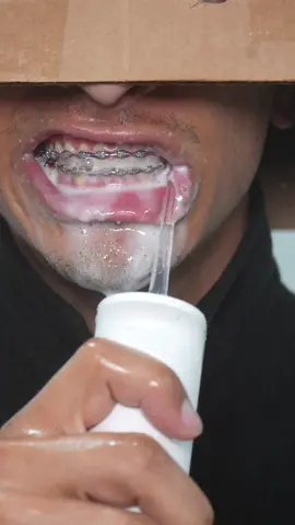 This works with braces  #gurunanda #waterflosser @GuruNanda LLC @Puneet Nanda bridge the gap #braces #bracestips #bracesoff #fyp #viral #food #candy #bracescolors #transformation #sour 