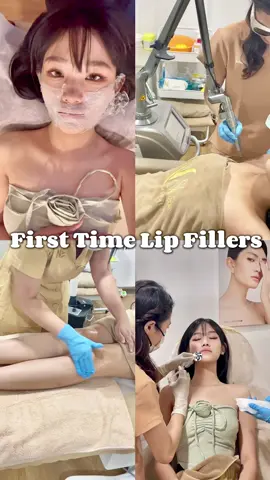 👄💉 #lipfiller #firsttime #experiencesharing 