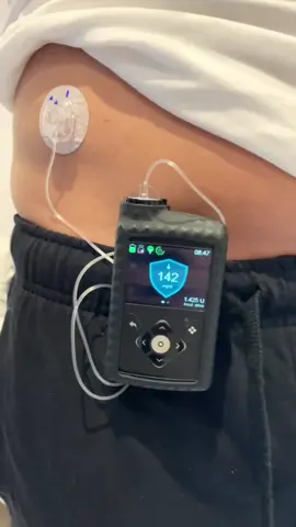 #diabetes #diabete #diabetestipo1 #diabetestipo2 