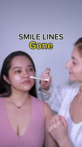 Get rid of smile lines with face fitness #facefitness #faceyoga #facefitnessexercise #smilelines #smilelinestreatment #nasolabialfolds #facemassage #facialmassagesteps 