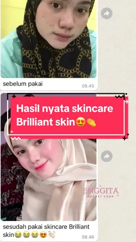 selalu ikut senang & bahagia setiap kali cust puas sama hasil skincare Brilliant skin yang beli sama kita😍😘👏 ✅untuk cara pakai yang baik & benar, gak perlu khawatir kalau beli sama kita pasti kita ajarin cara pakai yang baik & benar😍🥰👏 #skincarebrilliantskin #brilliantskinoriginal #CapCut 