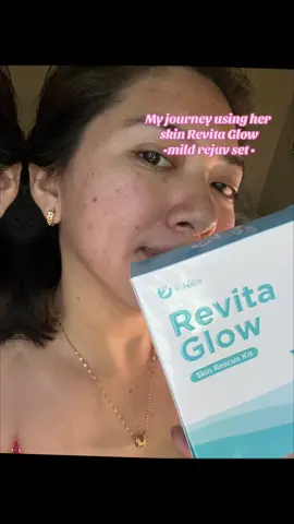 Here’s my update pala using Her Skin Revita glow skin rescue kit  ,perfect to sa mga naghahanap ng mild na rejuv #fyfyfyfyfyfyfyfyfyfyfyfyfyfyfyfyfyfy #rejuv #rejuvenatingset #herskin #revitaglow 