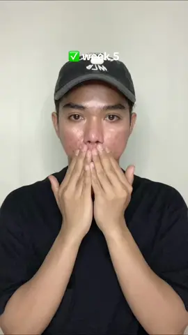 seger poll jeruknya 🍊🍊 #moisturizerviral #darkspotmoisturizer 