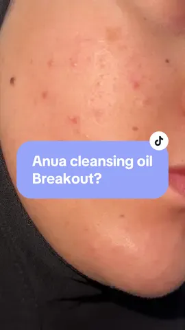 Anua cleansing oil is a scam? #skincare #skincareroutine #kbeautyskincare #skincaretips #anua #kbeautyskincare #koreanbeauty #doublecleansing 