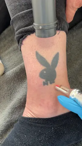 Bye Tattoo ✅ #tattoo #tattooremoval #fyp #asmr #picoplus #satisfying #brugge #tattooremovalspecialists #picolaser #detatouage #tattoos #playboy 