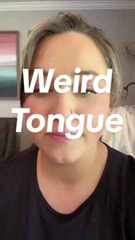 Ever since I got pregnant in 2020 I have had this geographical tongue, is what my dentist called it. Ever since getting it I cant eat spicy foods anymore 😩 can anyone else relate or tell me how to get rid of it?! #MomsofTikTok #momfollowparty #creatorsearchinsights #geographicaltongue #maptongue 