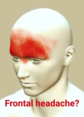 Discover more natural remedies#HeadacheRelief #Acupressure #NaturalRemedies #HolisticHealing #NaturaMedicine #WellnessTips#Videoleap 