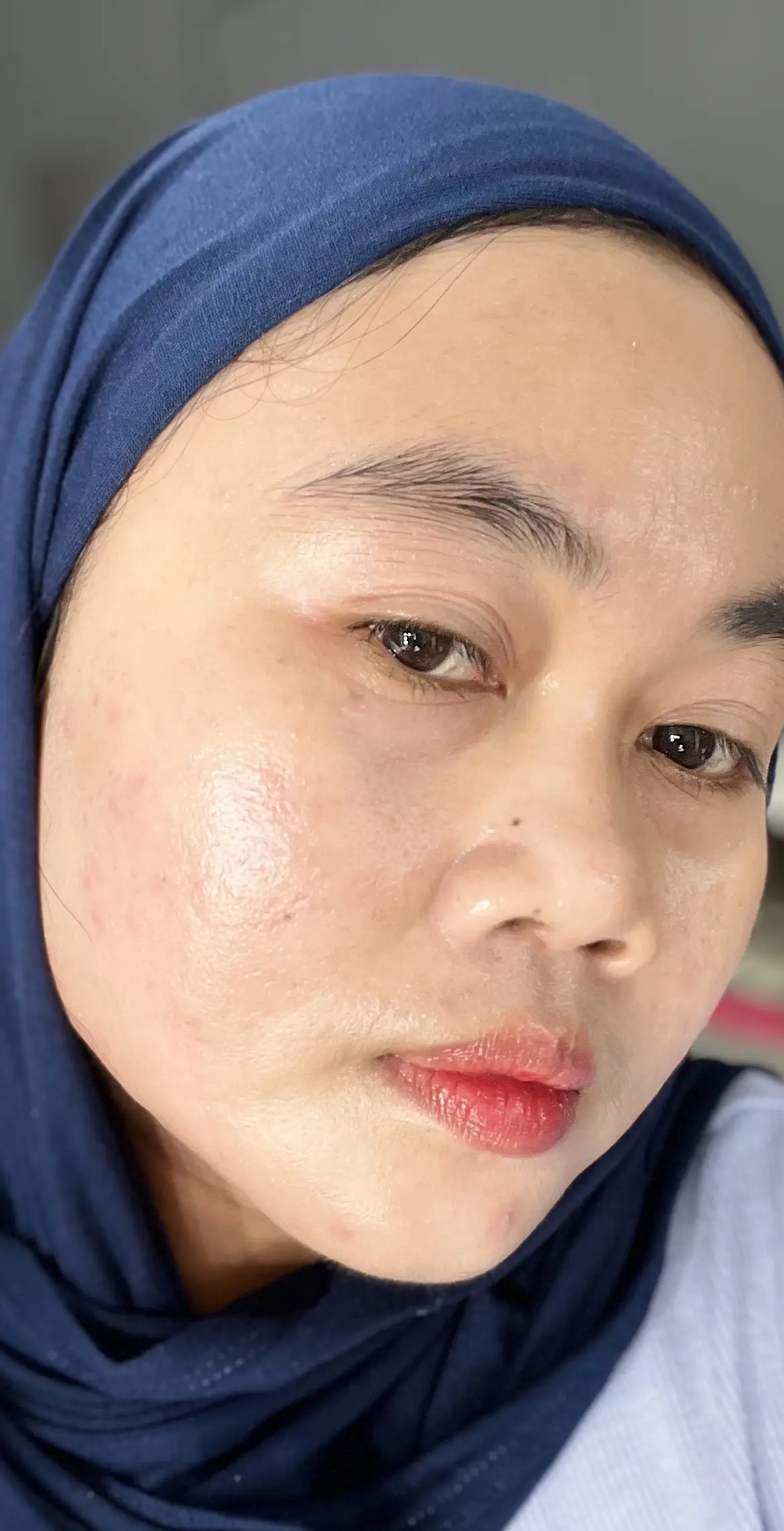 Skincare untuk kulit berjerawat. Skincare yang cocok untuk kulit acne prone skin. Ampuh atasi jerawat on off. Produk bgskin untuk berjerawat kemerahan dan jerawat hormonal.  Aku pakai sunscreen untuk kulit berjerawat, Acne care suncare bgskin. Aku juga pakai serum tea tree bgskin. Dan produk bgskin lainnya.  #bgskin #bgskincare #bgskinjawabarat 