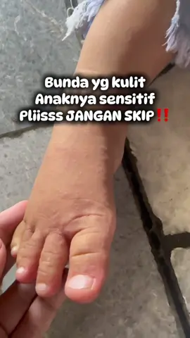 Bunda ada jg ga yg kulit anaknya sensitif? Disaranin ttel jaga kelembapan sikecil ya bun🥹 #kulitsensitif #baby #anak #skincareanak #skincarebayi #expertcare 