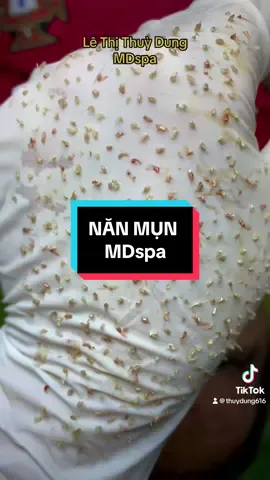 Chi chít mụn 🙈 #lethithuydung616 #mdspa_chuyên_mụn_rỗ_tpvinh #chuyên_đtri_mụn_rỗ_tpvinh_nghệan #nặn_mụn 