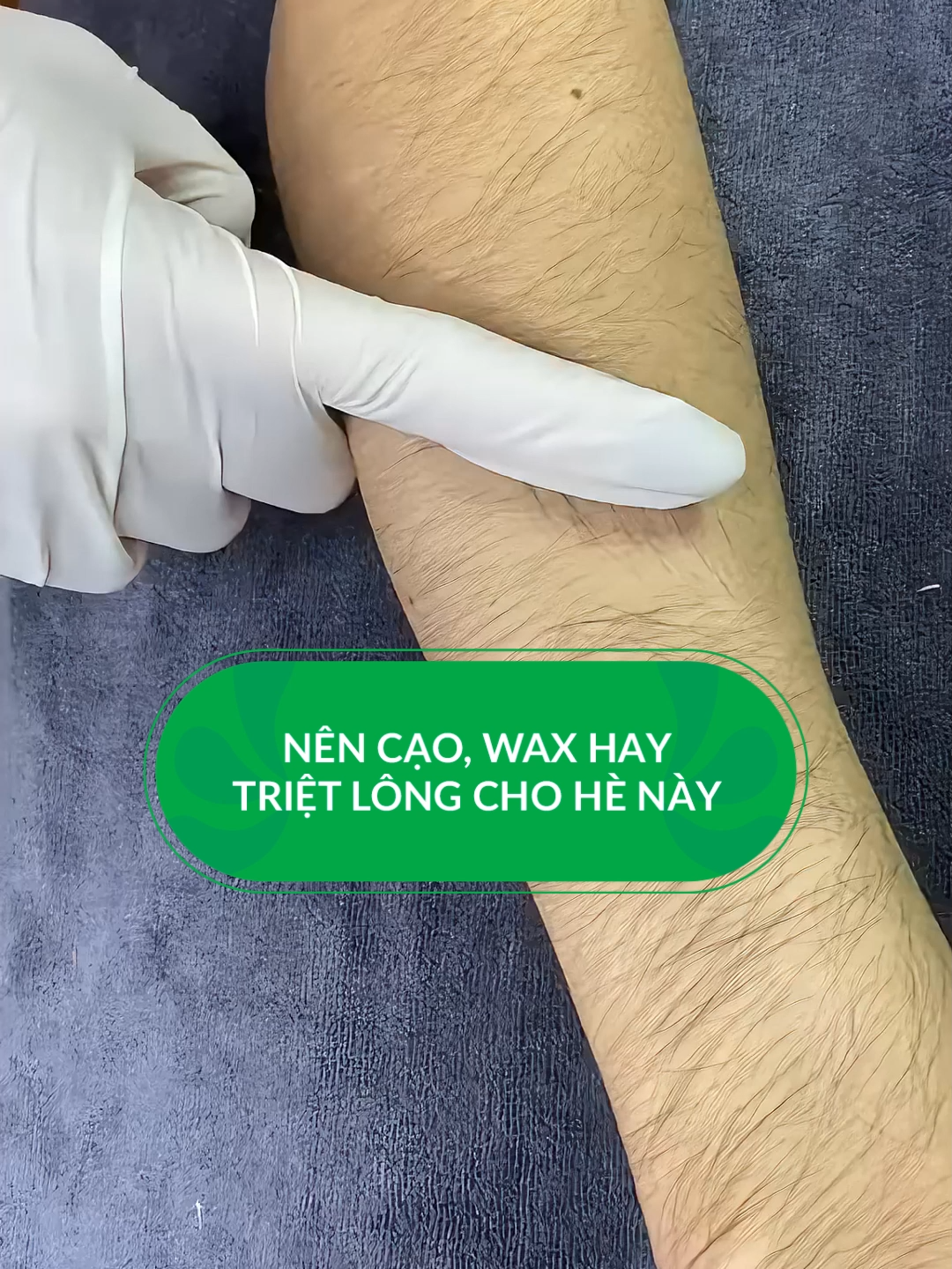 3 phương pháp dọn dẹp lông được các cô gái quan tâm nhất đây, bác sĩ khuyên các bạn nên triệt lông bằng máy công nghệ cao để đạt hiệu quả tối đa và lâu dài nhất #bsthuythucuc #dalieu #trietlong #waxlong #caolong