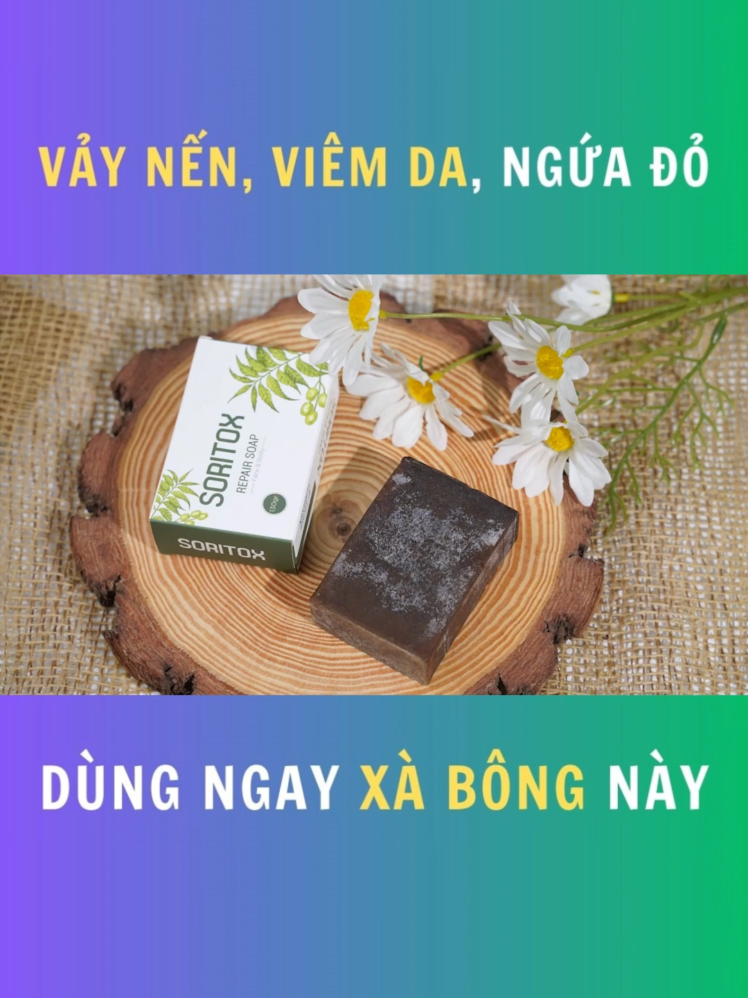 Chuyên dùng cho Vảy Nến, Viêm Da, Ngứa Đỏ #vaynen #viemda #soritox #xabongsoritox #xabongthaoduoc