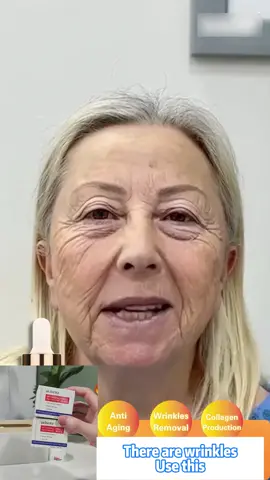 Remove Eyebags - Droopy Eyelids - Wrinkles - Dark Circles#wrinkle #wrinkleremoval 
