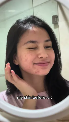 🥰🥰