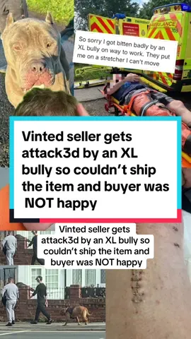 Vinted seller gets attack3d by an XL bully so couldn’t ship the item and buyer was NOT happy