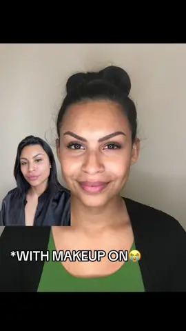 Keep in mind, this “before” photo of me at 18 is me also wearing a full face of makeup. I’m not wearing any makeup today.  #nanoblading - is definitely the type of microblading you should opt for. It looks the most natural and fades the best. I got ombre powder and wish I would’ve done nano.  #microneedling - if you’re 25 and up you need to be doing this once a year. It smoothes out your skin, gets rid of pigmentation and scars, shrinks your pores, gets rid of texture, and builds collagen in your face. If you’re 30+ do it three times a year. I’m 26 and i do it three times a year.  #undereyefiller - shes an icon. Definitely what made the most difference in my opinion. As i said, this DOES NOT go away and many people agree with that so make sure you’re going to an experienced injector. But if you have creases, lines, deep set, hollow eyes…its chefs kiss for smoothing that area out. 