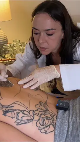 Asmr pore extraction - back exam  #asmr #asmrsounds #asmrsound #asmrsoundsdaily #asmrsoundsgirl #asmrsoundsontiktok #asmrvideo #asmrvideos #asmrvideosounds #asmrtiktoks #asmrtiktok #asmrtiktoks🦋asmr🦋 #asmrtiktokvideo #asmrtiktokvideos #asmrsoftspoken #softspokenasmr #asmrealperson #realpersonasmr #asmr_tingles #asmrroleplays #asmrroleplay #roleplayasmr #asmrmedical #asmrmedicalroleplay #asmrmedicalexam #asmrdoctor #asmrdoctorroleplay #asmrdoc #asmrdoctorexam #asmrhealing #asmrchiropractic #asmrtingles #asmrtingle #asmrtinglesvideos #asmrtinglesforsleep #tingles #tingle #tinglesounds #tinglesasmr #tingly #tinglyasmr #tinglysounds #asmrtrigger #asmrtriggers #asmrtriggerwords #asmrtriggersounds #asmrtriggername #triggerasmr #triggersasmr #asmrsleepy #asmrsleep #asmrsleeptriggers #asmrsleeprelax #asmrsleepandrelax #asmrsleepclinic #asmrsleeptingles #sleep #sleepyday #sleepy #sleeping #sleeptime #sleepytime #medicalasmr #doctorasmr #asmrheadtotoe #asmrcheckup #asmrfullbodyexam #asmrexam #sleeptriggers #sleepvideos #sleepasmr #sleepasmrtriggers #sleepyasmr #sleepyhead #asmrrelax #asmrrelaxing #asmrrelajante #asmrrelaxante #asmrrelaxation #asmrrelaxingsounds #asmrrelaxingvideos #asmrrelaxingvideo #asmrrelaxandsleep #asmrrelaxingspa #relaxasmr #relaxingasmr #relaxingasmrsounds #relaxingasmrvideos #relaxation #relaxationviibes #relax #relaxing #relaxingvideos #relaxingvideo #relaxingsounds #relaxante #relajante #relaxar #relaxtime #relaxify #asmrtist #asmrtistsoftiktok #asmrtists #asmrback #asmrbackmassage #asmrbackexam #asmrmassage #asmrchiropractic #backexam #asmrbacktracing #physicaltherapy #physicaltherapist #chiropractortiktok #chiropractor #backmassage