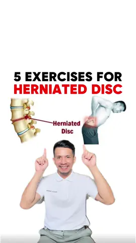 5 EXERCISES FOR HERNIATED DISC!! 🤩🤩🤩 #discherniation #herniateddiscs #backpain #sciaticarelief 