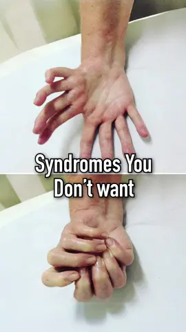 Note: The most severe cases of compartment syndrome are terrible, like behind the eye. Don’t look that up 👍 #Jearrod #interesting #top3 #syndrome #phantompregnancy #foryou
