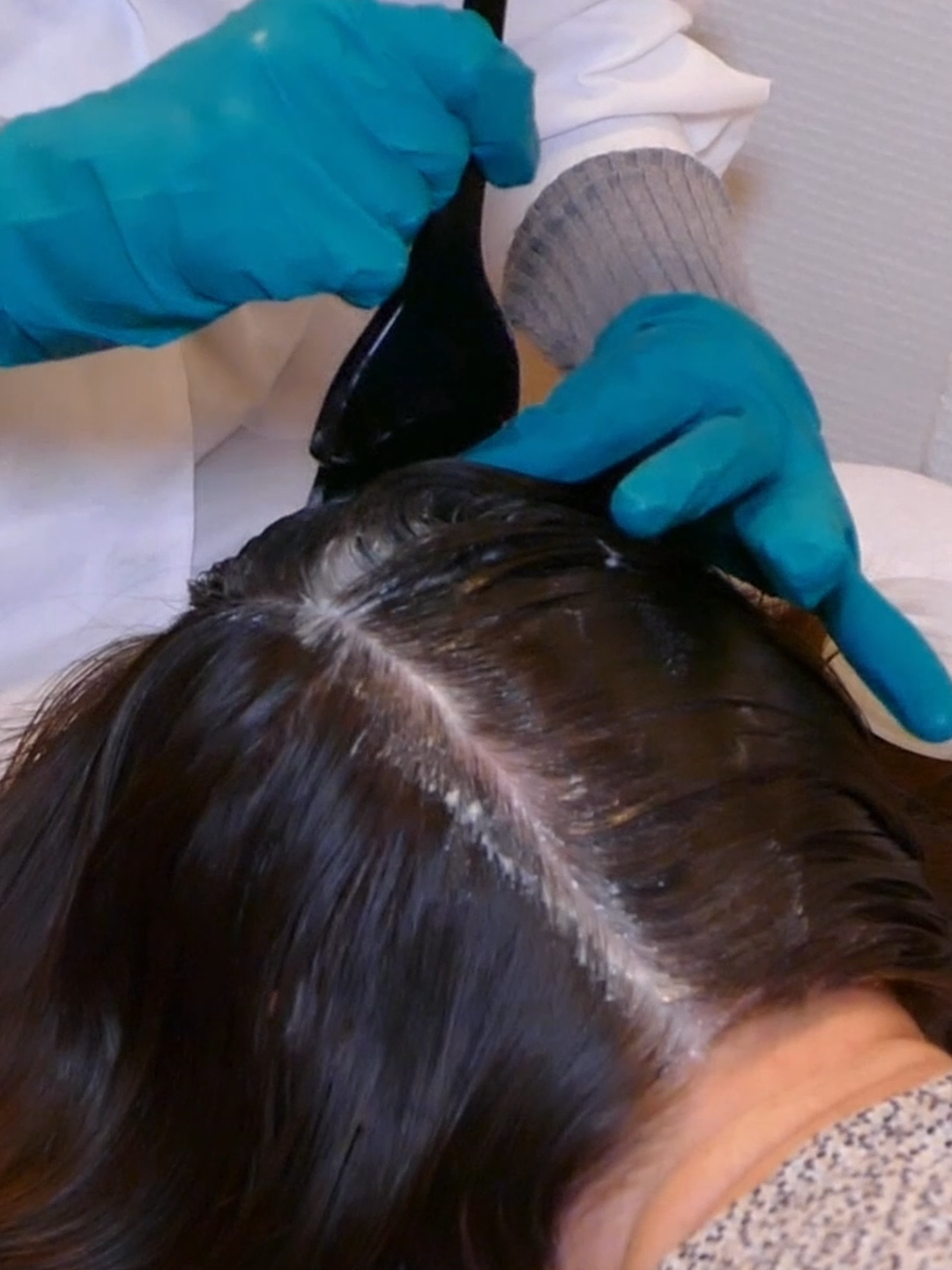 ASMR Itchy SCALP Exam and TREATMENT (Real Person) #asmr #asmrsounds #asmrvideo #asmrtiktoks #scalp #scalpcheck #asmrsensory #asmrroleplay #asmrmedical #asmrdoctorroleplay