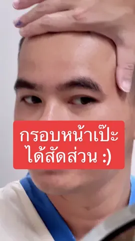 ออกแบบสัดส่วนเป๊ะ รับกับรูปหน้า 😎✍🏻❣️ #ปลูกผมกับหมอพอล #เทคนิคดีบอกต่อ♥️♥️ #allaboutclinicthailand #ปลูกผมที่ไหนดี #ปลูกผมที่สวยที่สุด #Hairtransplant #หมอพอลaac #ปลูกผม 