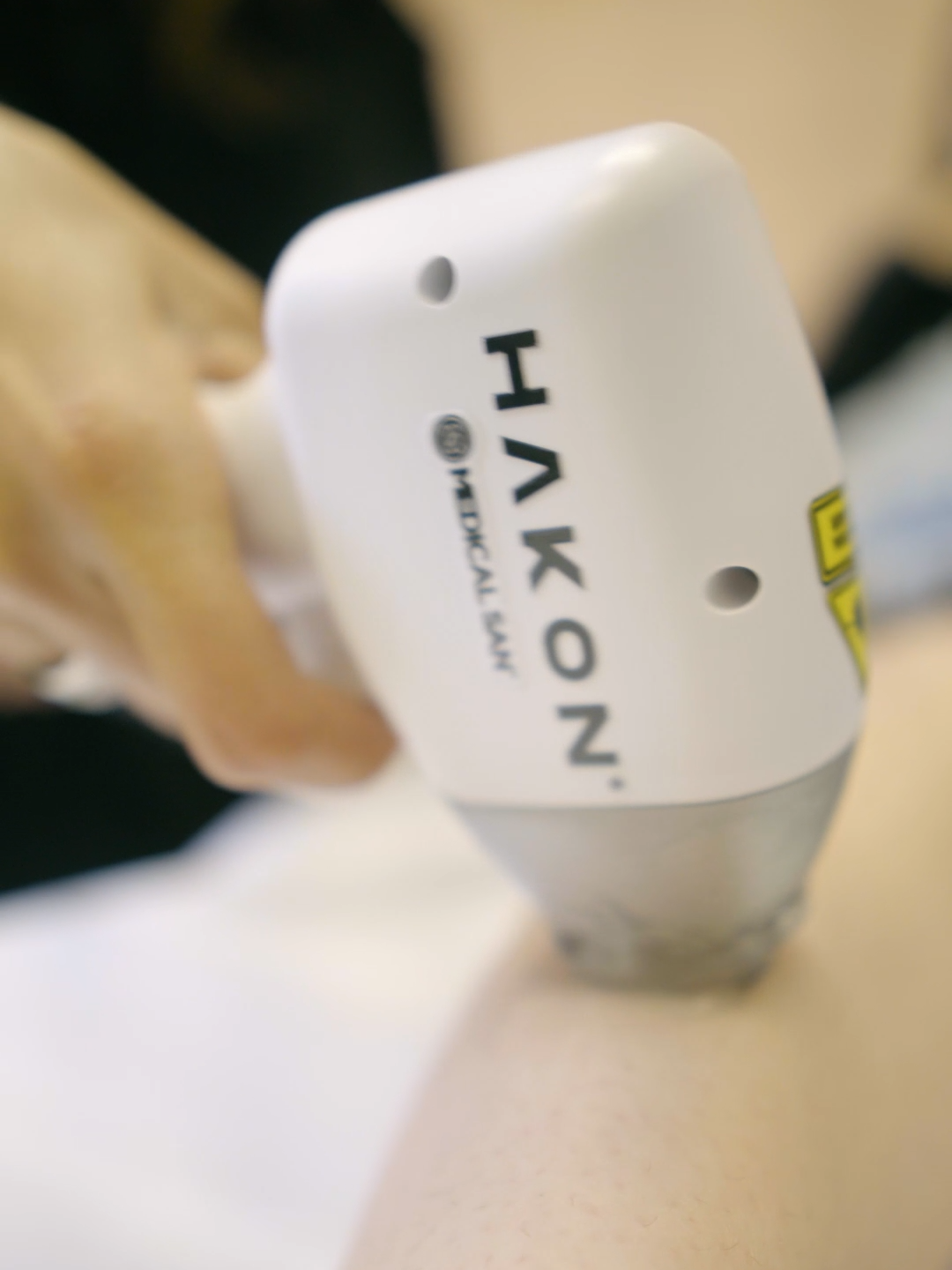 🗝️O Hakon é a virada de chave que sua clínica precisa!   Com tecnologia 4D, ele combina lasers Rubi, Alexandrite, Diodo e ND Yag para uma epilação mais eficaz para todos os fototipos de pele, até as bronzeadas.   ❄️O sistema de resfriamento atinge -12° em 50 segundos, garantindo uma aplicação segura e agradável, além disso com os modos de aplicação pontual e varredura resultados ficam ainda melhores.   Liberte seus clientes das lâminas e ceras. Abrace o futuro com o Hakon!   #hakon #epilacaoalaser #depilacaoalaser #pelelisinha #esteticacorporal #xopelos #esteticaavancada