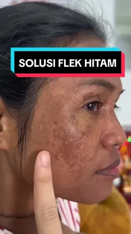 #top #viral #serum #foryoupage 