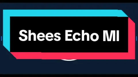 Sound Effects - Shees Ml |Echo Ph #soundeffects #weplay #soundviral #mentahan #mlbb #mobilelegends #fyp #weplaytime 