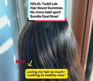 HALAL Teddi Lab Hair Boost Gummies! No more bald spot! Increase Hair Volume, Stronger Healthier Hair! #fyp #foryoupage #foryou #viral #viralvideo #homejoysg #viraltiktok #epictrending #trending #trendingvideo #trendingtiktok #trendingnow ##TikTokMadeMeBuyIt #tiktoksg #tiktoksgviral #lifehacks #lifehacks #homejoysg #travellife #travelhack #traveltips #shoppinghaul #ladiesfashion #shoppingonline #上热门 #好物分享 #上推薦通知我 #上推薦 #beautyhacks #beautyhack #beautytips #TikTokSale #TikTokShopSGSale #goodthingsrecommended #goodthingsinlife #goodthingsharing #goodproduct #TikTokFashion #BeautyReview #beautytutorial #tiktokshopsg #beautysecrets #createtowin #weeklywedrush #tiktoksgcommunity #friyaysale #tiktokshopsg #tiktokshopsgsale #hairbooster #teddilab #hairboostgummies #hairloss #baldspot #stronghair #healthyhair 