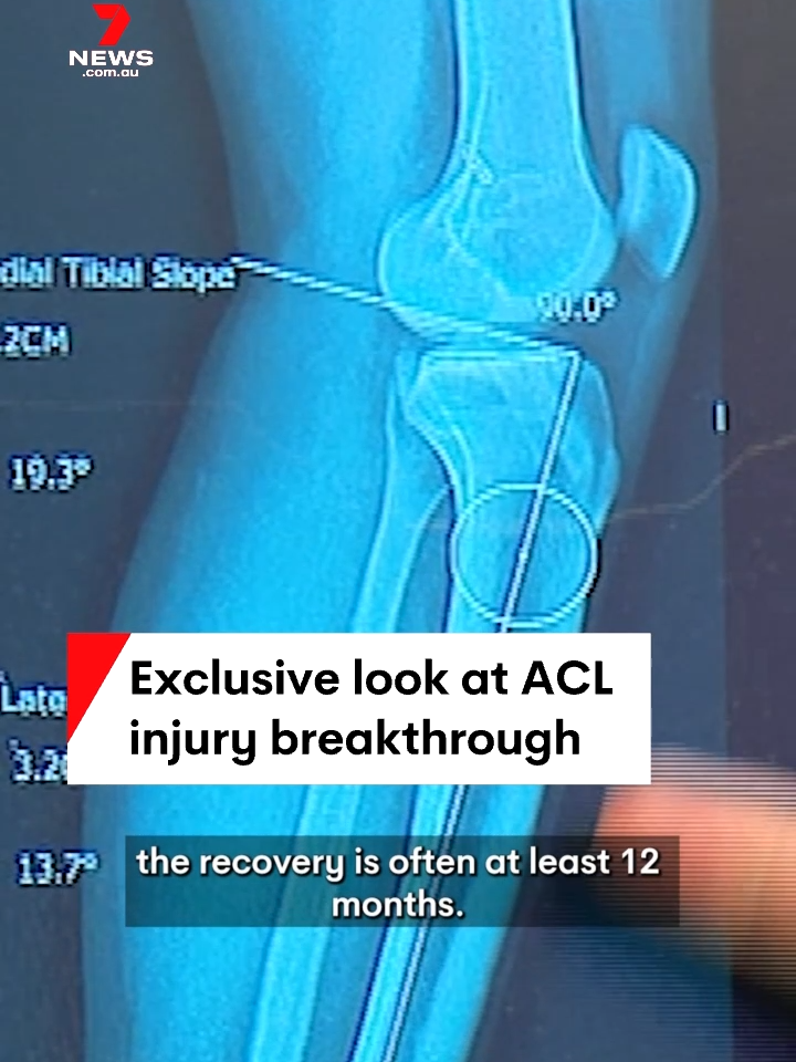 An exclusive look into a groundbreaking new surgery offering renewed hope for athletes suffering ACL injuries will be revealed on 7NEWS, tonight at six. #exclusive #aclsurgery #breakthrough #7NEWS