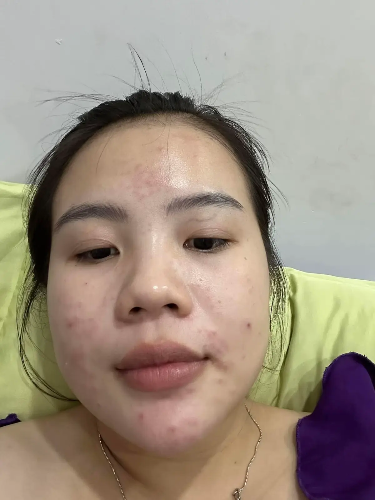 Trời ơi quá đỉnh lun rồi 🥰🥰🥰#DEMEJINE_CHÍNH_HÃNG #kemdemejinehànquốcchính_hãng #dưỡngtrangdamat #demejinehanquoc #dưỡngtrangda #trịmụn #xuhướng #CapCut 