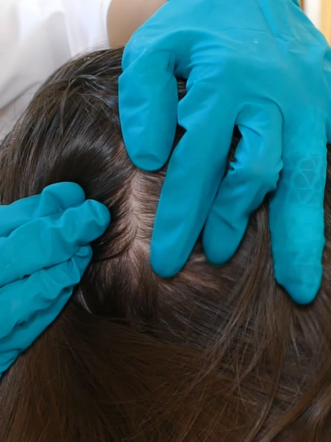 ASMR Perfectionist SCALP Check with BAD Results and TREATMENT (Real Person)  #asmr #asmrsounds #asmrvideo #asmrtiktoks #scalp #scalpcheck #asmrsensory #asmrroleplay #asmrmedical #asmrdoctorroleplay