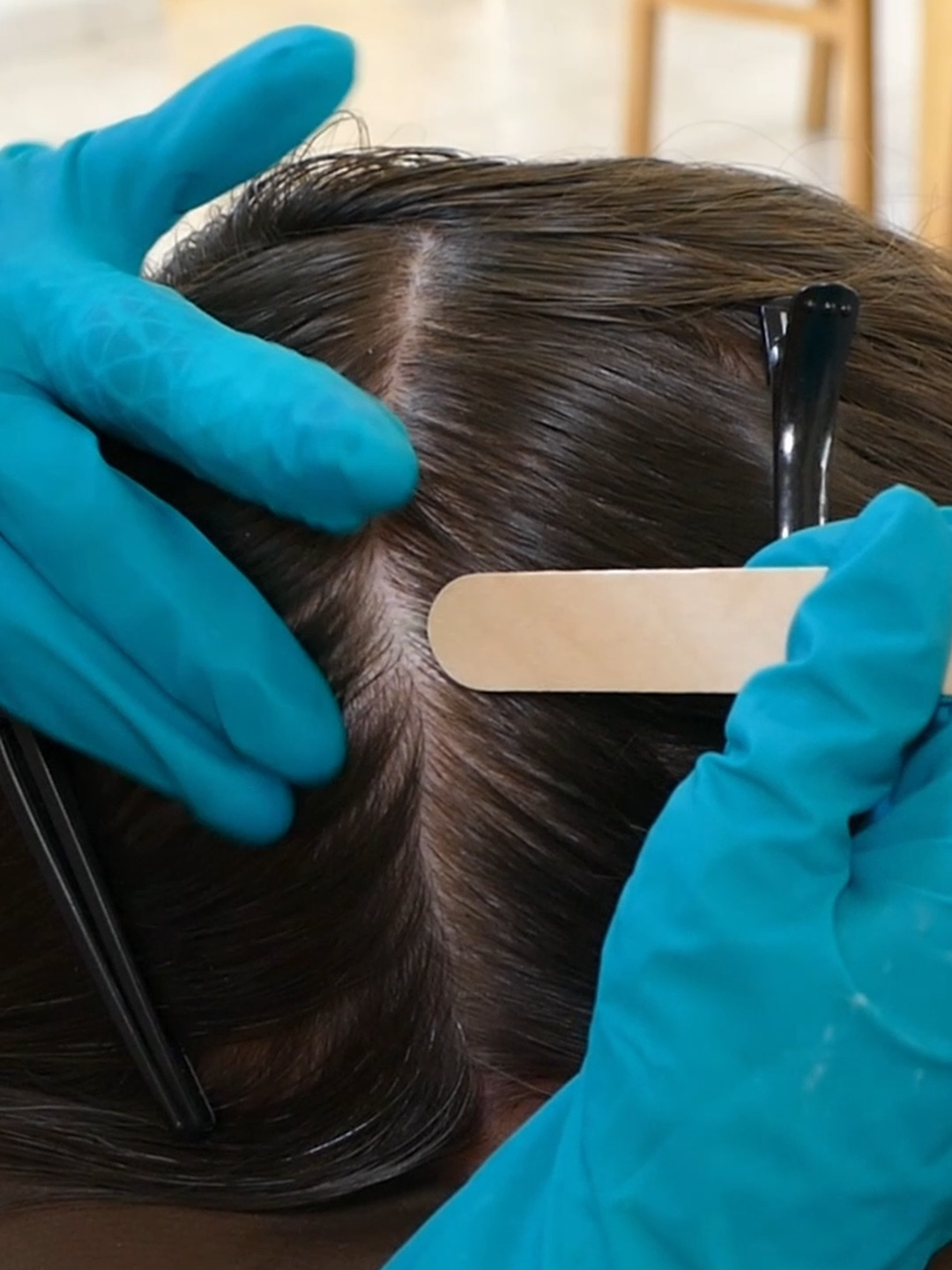 ASMR Perfectionist SCALP Check with BAD Results and TREATMENT (Real Person)  #asmr #asmrsounds #asmrvideo #asmrtiktoks #scalp #scalpcheck #asmrsensory #asmrroleplay #asmrmedical #asmrdoctorroleplay