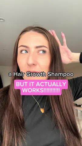 I promise you with every inch of me, THIS STUFF WORKS. @Regrowz #affiliate #gifted #haircare #hairgrowth #howtoquicklygrowyourhair #postpartum #hairloss 