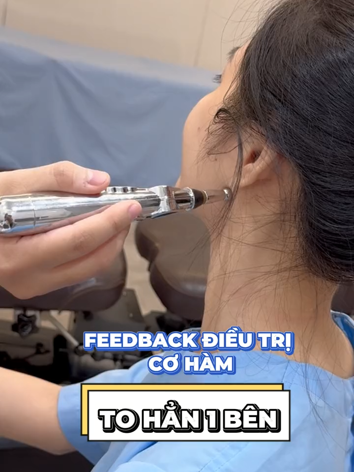 Feedback điều trị cơ hàm to hẳn 1 bên #ibone #ibonefisio #lechmat #xuhuong #lechham #viral