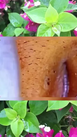 #squeeze #squeezeyuk #acne #pimple #pimplepop #blackhead #satisfying #foryoupage