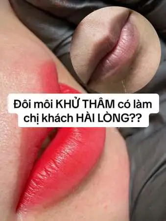 1 lượt khử thâm cho chị khách xinh đẹp #lamdep #xuhuong #trending #viral #TikTokAwardsVN #LearnOnTikTok #phunmoi #khuthammoi #phunmoitebaogoc #lips #phunxamthammy #phunxamthammychuyennghiep #pmu #moidep #phunxamthammynhatrang #khuthammoinhatrang