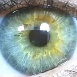 Central heterchromia eyes.. #centralheterochromia #centralheterochromiaeyes #aesthetic #fypシ゚viral #viralvideos #fyp 