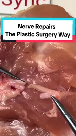 Nerve repair AKA nerve coaptation  Epineural suture with magnification  Simulated on the dangly bits from a chicken thigh  https://www.medsyncltd.com/osips #nerverepair #microsurgery #surgeon #neurosurgeon #plasticsurgery #meded #microscope #nerve #orthopedics #explore #chickenthighs #simulation 