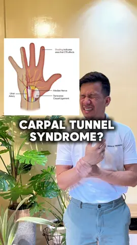 CARPAL TUNNEL SYNDROME HOME EXERCISES!! 🤩 #carpaltunnelsyndrome #carpaltunnelpain #trending 