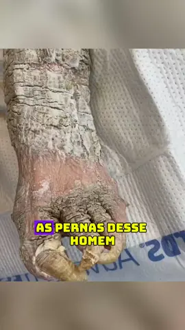 #medico #historiareal #historia #casosmisteriosos #criatura #relatos #casos #caso 