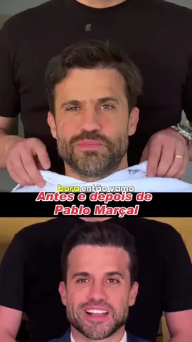 Transformação de Pablo Marçal. #pablomarçal#visagismo#fy 
