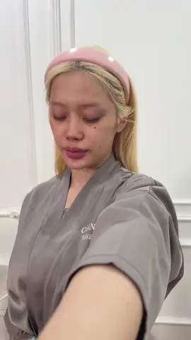 Vịt hoá thiên nga. #trendbienhinh #makeup 