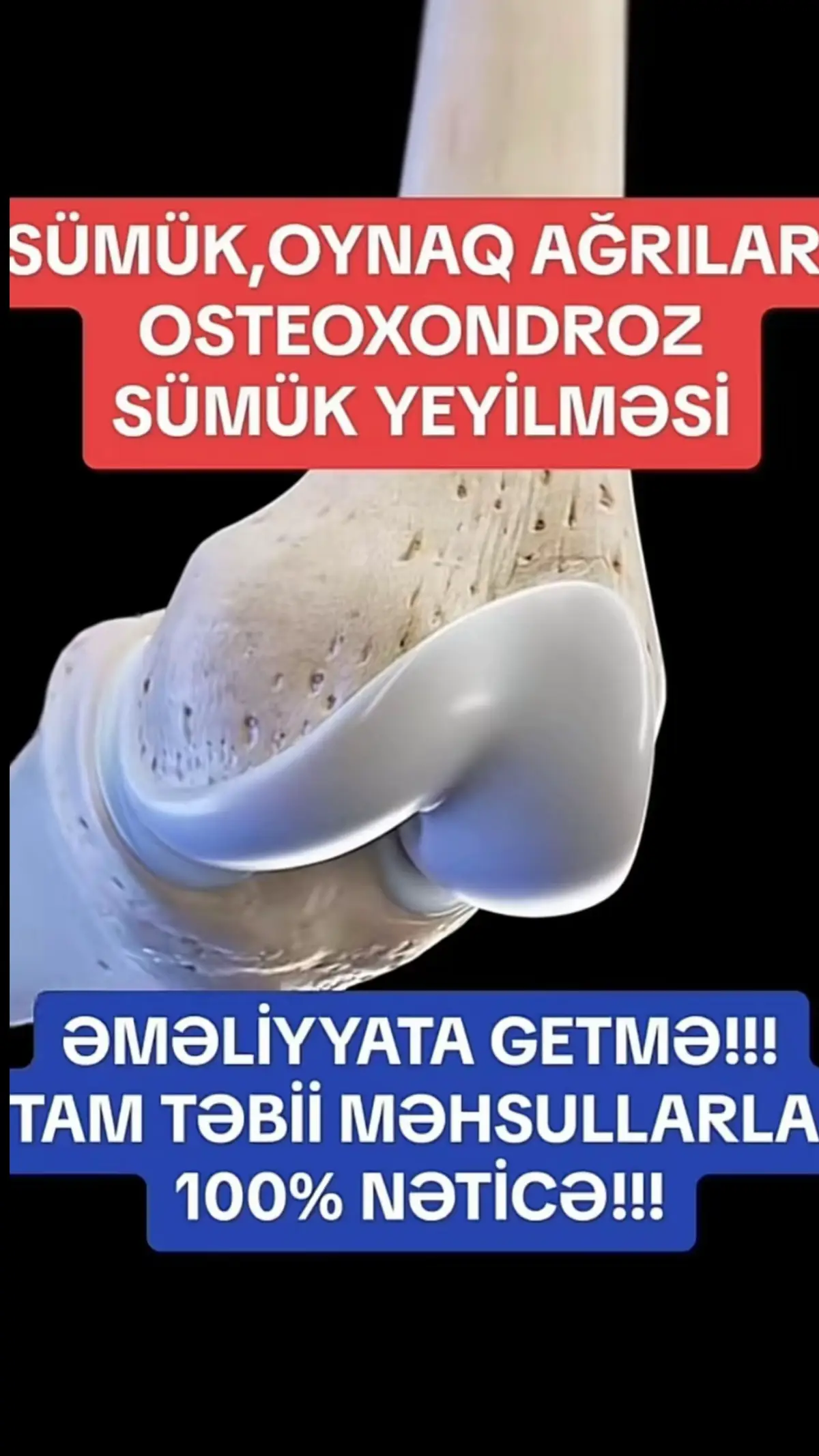 Daxilden tebii yolla kalsium ile mualicedir 🥰 #kesfet #fyppppppppppppppppppppppp #viralvideo #viral 