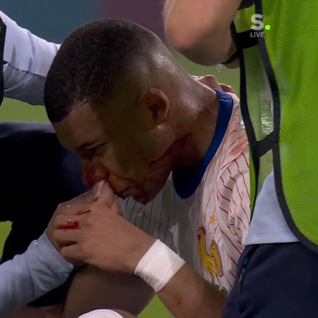 We’re cooked. #chrvpeditz #fypageシ #fyp #kylianmbappe #mbappe #kylianmbappe🇫🇷 #football 
