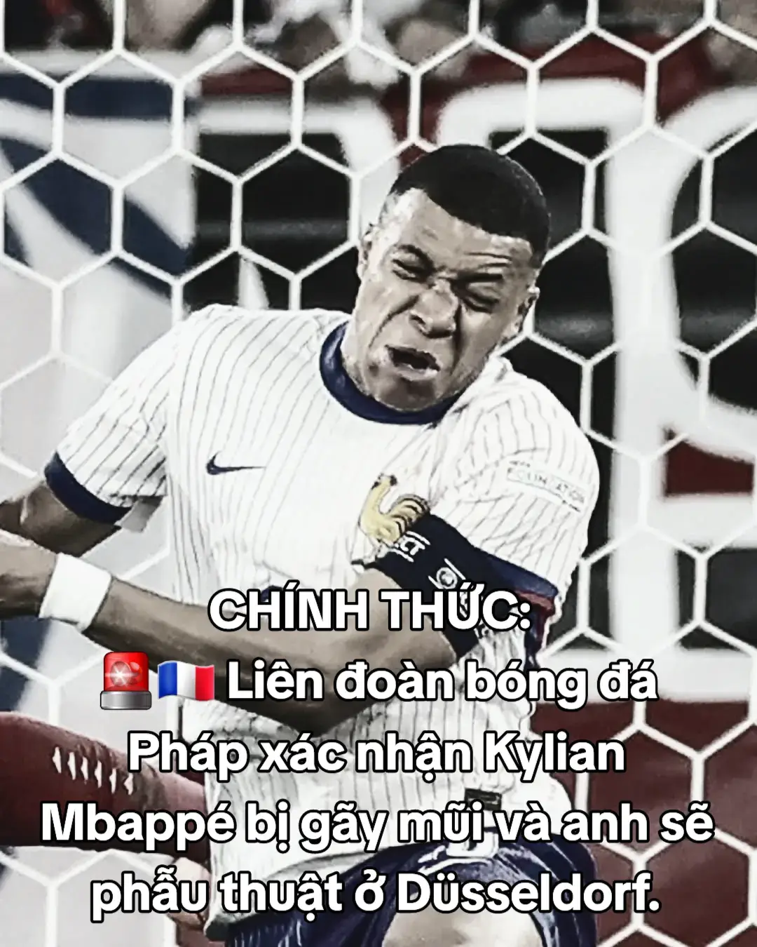 #mbappe #doituyenphap #mbappebigaymui #euro #bongdahomnay #tongthongphap #dexuat #thinhhanh 